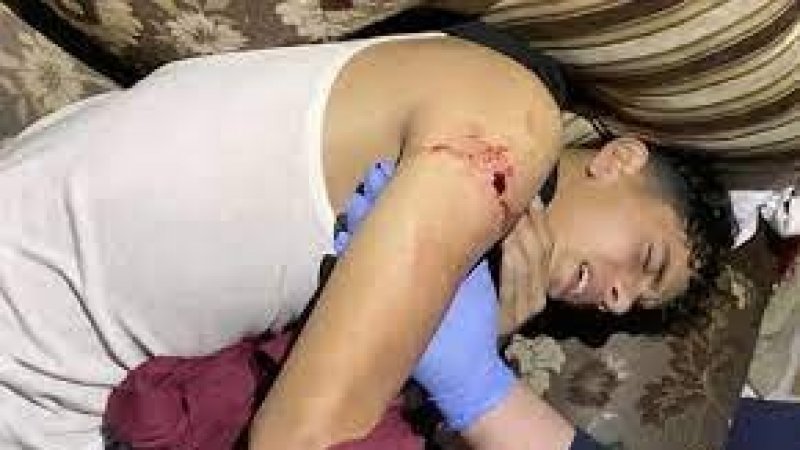 إصابة فتى فلسطيني برصاص مستوطن اسرائيلي في البلدة القديمة في القدس