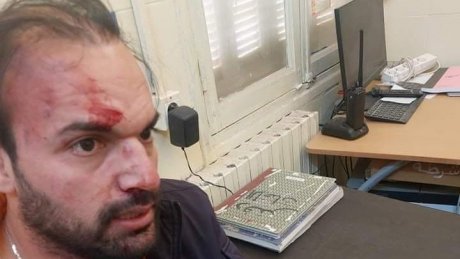 قفصة: تعنيف طبيب انجر عنه كسر في الأنف لأنه قرّر تأجيل عملية جراحية بسبب مانع طبي