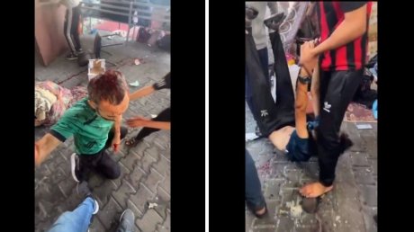 الاحتلال يرتكب مجزرة جديدة بعد قصف العيادة الخارجية لمستشفى الشفاء بغزة