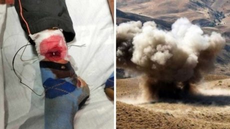 القصرين: مندوبية الأسرة تتعهّد بمتابعة وضعيّة طفل أصيب في انفجار لغم