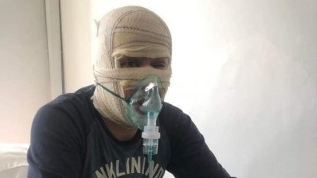 حريق مستودع الغاز برادس: لولا تدخل العمال القياسي والمخاطرة بحياتهم لكانت النتائج كارثية أكثر
