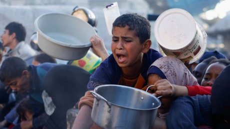 تحذيرات من استمرار التجويع بغزة وسوء التغذية يفتك بالأطفال