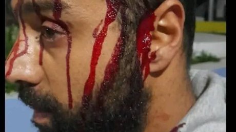 اعتداء بالعنف الشديد على حارس ليلي بمعهد المرسى يدفع الأسرة التربوية إلى التصعيد